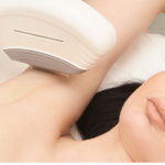 painless laser hair removal