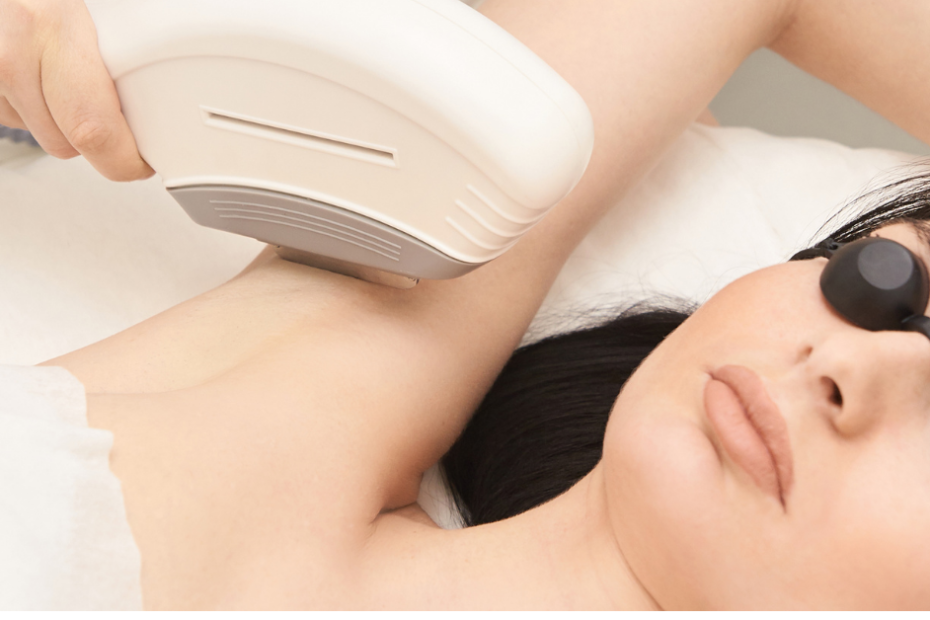 painless laser hair removal